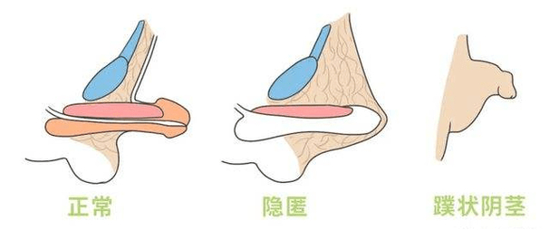 鸡年男孩取名禁忌_男性生殖器别称 小鸡鸡由来 儿童性教育用词